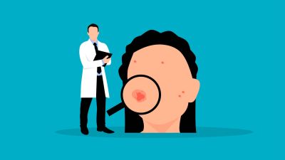Beküldött kép alapján ismeri fel a bőrbetegségeket a Semmelweis Egyetem új technológiája