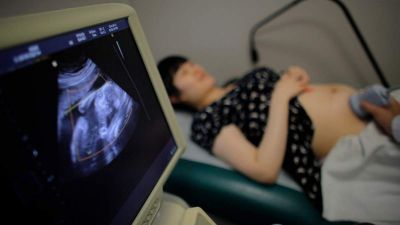 Tilos lesz az abortusz az USA egyik államában, amint hallani a magzat szívhangját