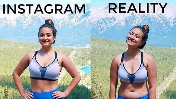 Szűrni kezdi a súlycsökkentők és plasztikai beavatkozások reklámjait az Instagram